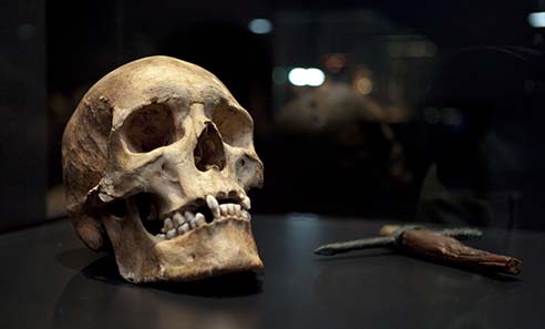 This scull shows traces of a stroke, which was effected by a war pickax. A weapon like this formed part of the burial ensemble of Ak-Alacha. There a double grave was found. The pickax belonged to a 16 year old woman. Photo: Peter Haag-Kirchner/Historisches Museum der Pfalz Speyer.