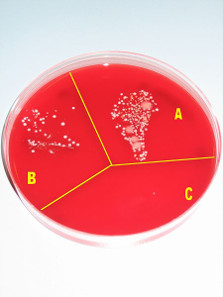 Microbial growth on a blood agar plate without any procedure (sector A), after washing hands (sector B), and after disinfecting hands with alcohol (sector C). Photograph: Pöllö / https://creativecommons.org/licenses/by-sa/3.0/deed.en