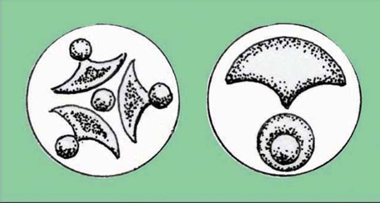 Cusp-and-roundel motifs, like Carl's Crown, on Iceni linchpin terminals from Weeting and Tattersett, Norfolk, c. 1st century BC/AD. Source: Jane Bottomley.