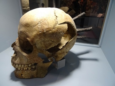 Or inside a dead body. Photo: KW.